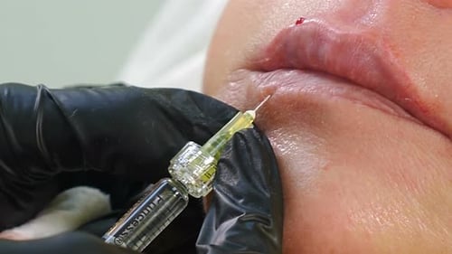 Lip Injection Cosmetic Surgery Beauty Treatment Close Up