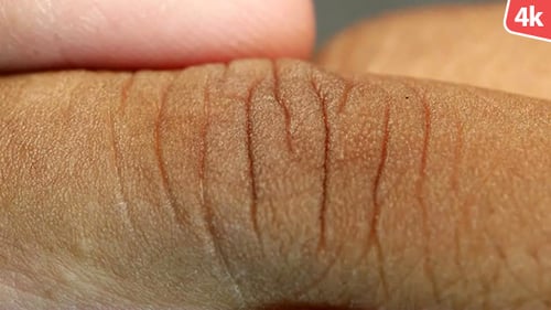 Human Skin 685