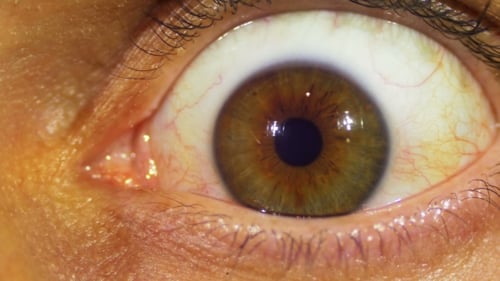 Eye Sight