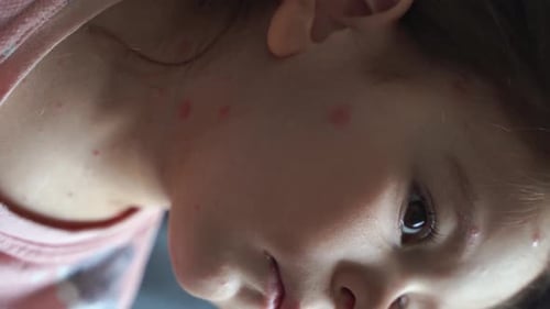 Child with Skin Spots Close Up View