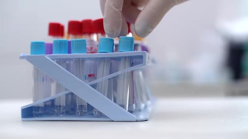 Close-up of Hand Wearing Medical Glove, Taking Blood Test Tube.