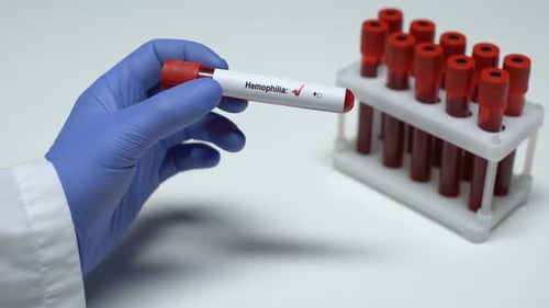 Hemophilia Positive Blood Test Close Up