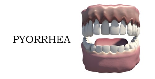 3D Human Jaw Orthodontic Correction Animation