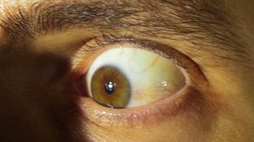 Macro Shot of Opening Human Eye