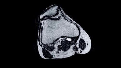 Medical MRI Scan of a Leg Anatomy