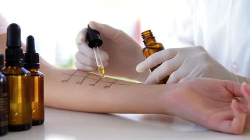 Nahaufnahme einer Therapeutin, die Allergietests an ihrer Patientin durchführt