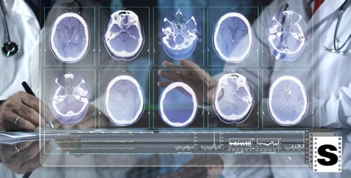 Brain Mri Scan