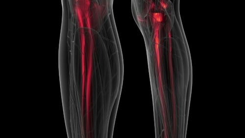 3D Human Body Scan Highlighting Bones and Joint Pain