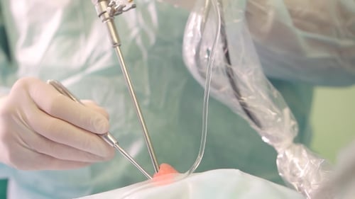 Doctor Performs Endoscopic Surgery Removing a Brain Tumor.