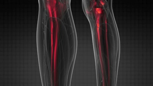Human Skeleton Scan with Glowing Bones and Joints