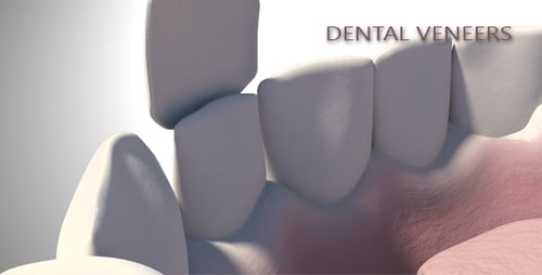 3D Dental Anatomy Animation of a Tooth Restoration