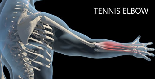 3D Human Musculoskeletal System Pain Animation