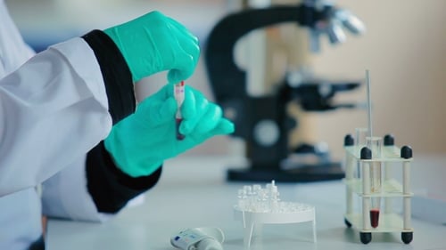 Scientist Pours Blood Into a Small Jar.