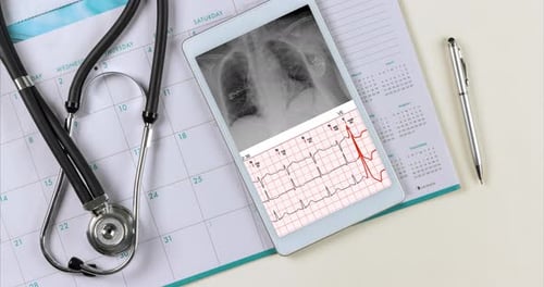 Nach der Installation von Herzschrittmachern, Röntgen, Brust und Elektrokardiogramm der Welle melden Sie sich digital in der Tablet-Ansicht