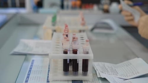 Blood Samples in Test Tubes in a Lab