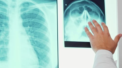 Male Hand Moves on the X-ray