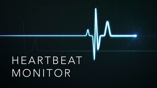 Animated EKG Heartbeat Monitor Loop with Grid Background