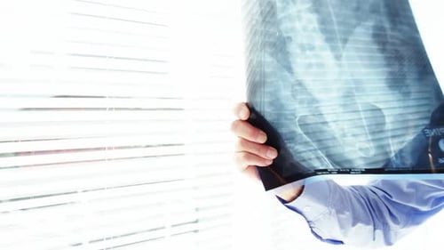 Male Doctor Examining X-Ray In Hospital Office
