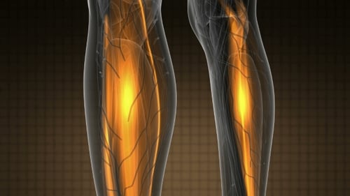 Human Body Anatomy Scan with Glowing Muscles Animation