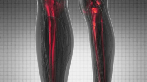 Human Body Bones Glowing Red Pain Medical Scan