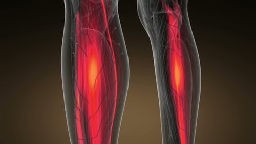 3D Medical Animation of Glowing Human Muscle Anatomy