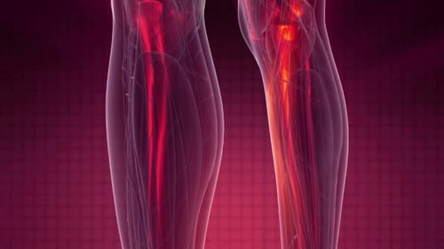 Human Body Medical Scan with Pain Points Animation