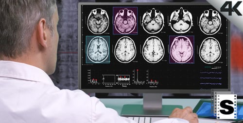 Doctor Viewing Brain Scans on Computer Screens