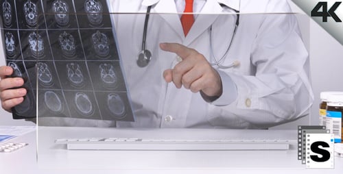 Doctor Reviews Brain Scan in Clinic