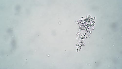 Un grupo de ciliados se alimenta moviendo muy rápidamente el fondo del microcosmos