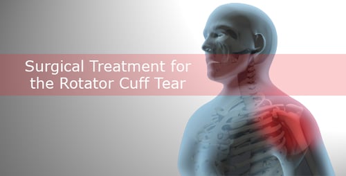 3D Medical Animation of Shoulder Joint Surgical Repair