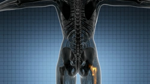 Digital Scan of Human Anatomy with Glowing Femur and Hip Joint