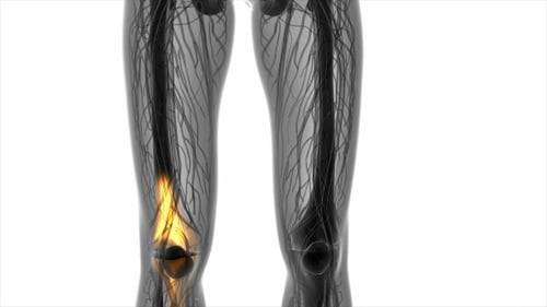 3D Human Anatomy Knee Pain Medical Visualization