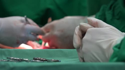Surgeons Performing Operation in Hospital Operating Room