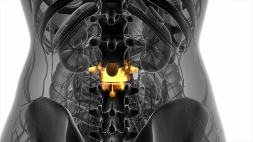 Backache in Back Bones