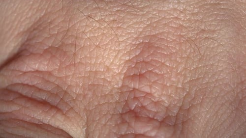 Human Skin Macro Background