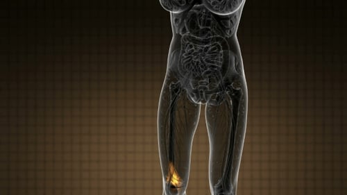 Human Body X-Ray Scan Showing Knee and Leg Pain Animation