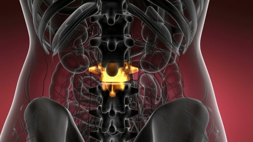 Backache in Back Bones