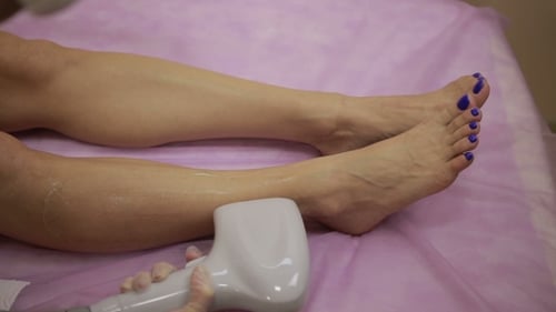Laser Hair Removal Treatment on a Woman's Leg