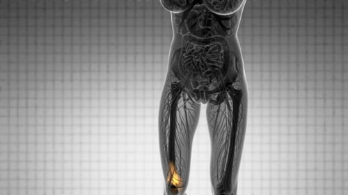 Medical Visualization of Human Knee Pain