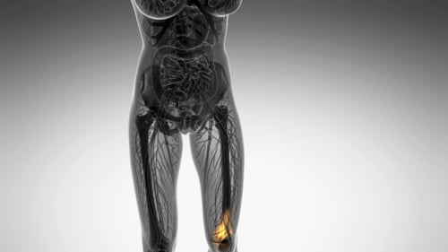 Animated Medical Visualization of Human Leg Bones