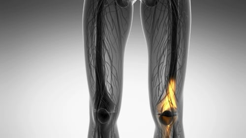 3D Human Leg Anatomy Scan with Knee Pain Highlight