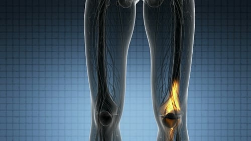 Detailed Medical Animation of Knee Pain and Inflammation