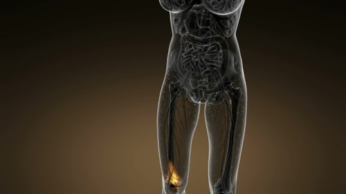 3D Human Anatomy with Animated Knee Pain Highlight