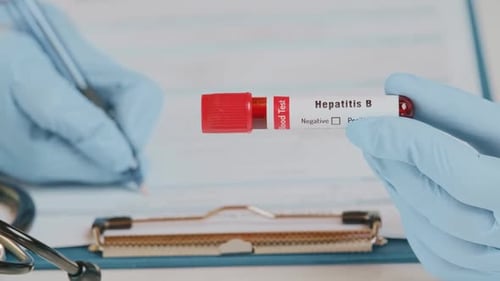 Hepatitis B Blood Test being Analyzed