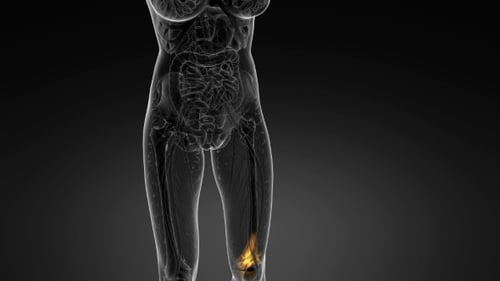 3D Medical Animation of Human Knee Pain