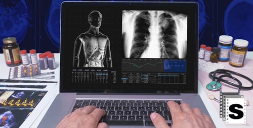 Doctor Types on Laptop Reviewing X-Rays and Charts