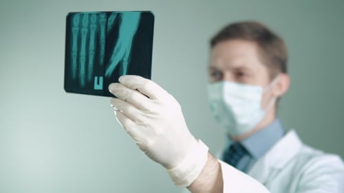 Doctor Examining Hand X-Ray in Hospital Setting