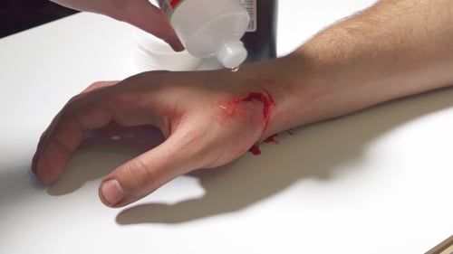 Treatment of a Wound After a Dog Bite