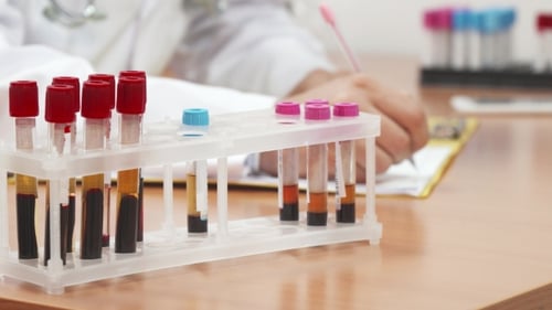 Blood Samples in Lab, Medical Research