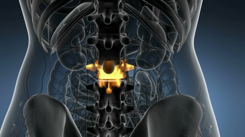 Backache in Back Bones
